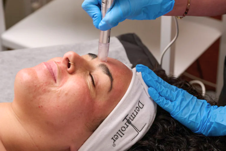 XCellarisPRO Twist (Microneedling) 3