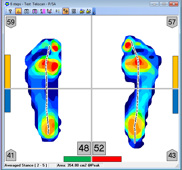 FootMat Software for Researchers 1