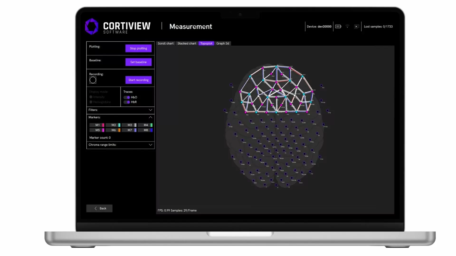 CortiView 2 Software 1