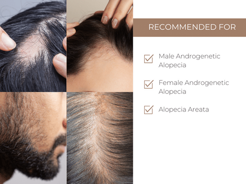 XCellarisPro Professional Hair Treatment 2