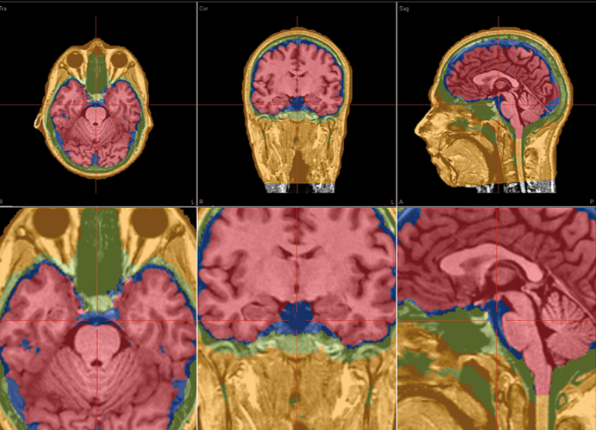 BESA MRI 1