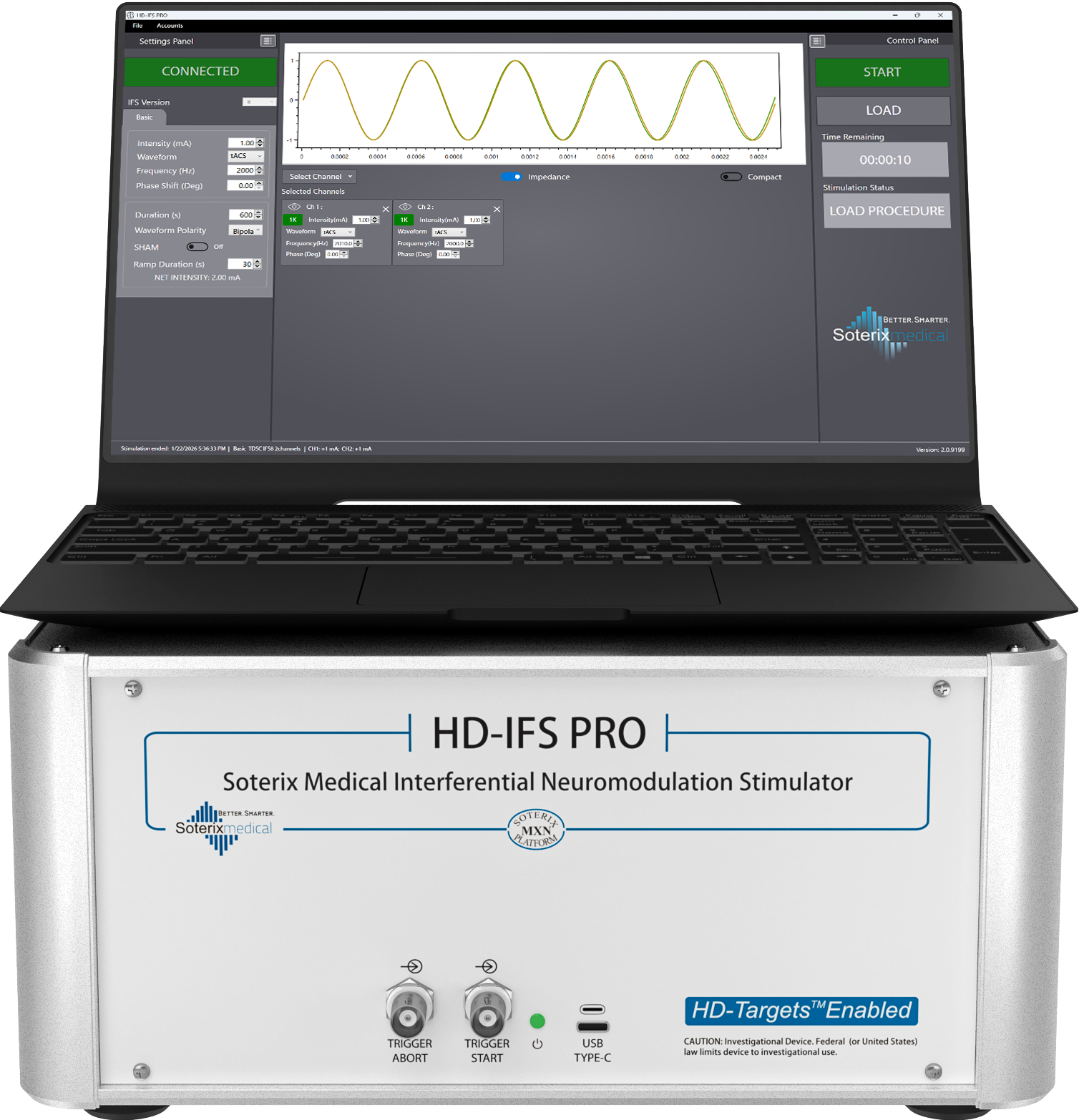 Temporal Interference Stimulation System 1