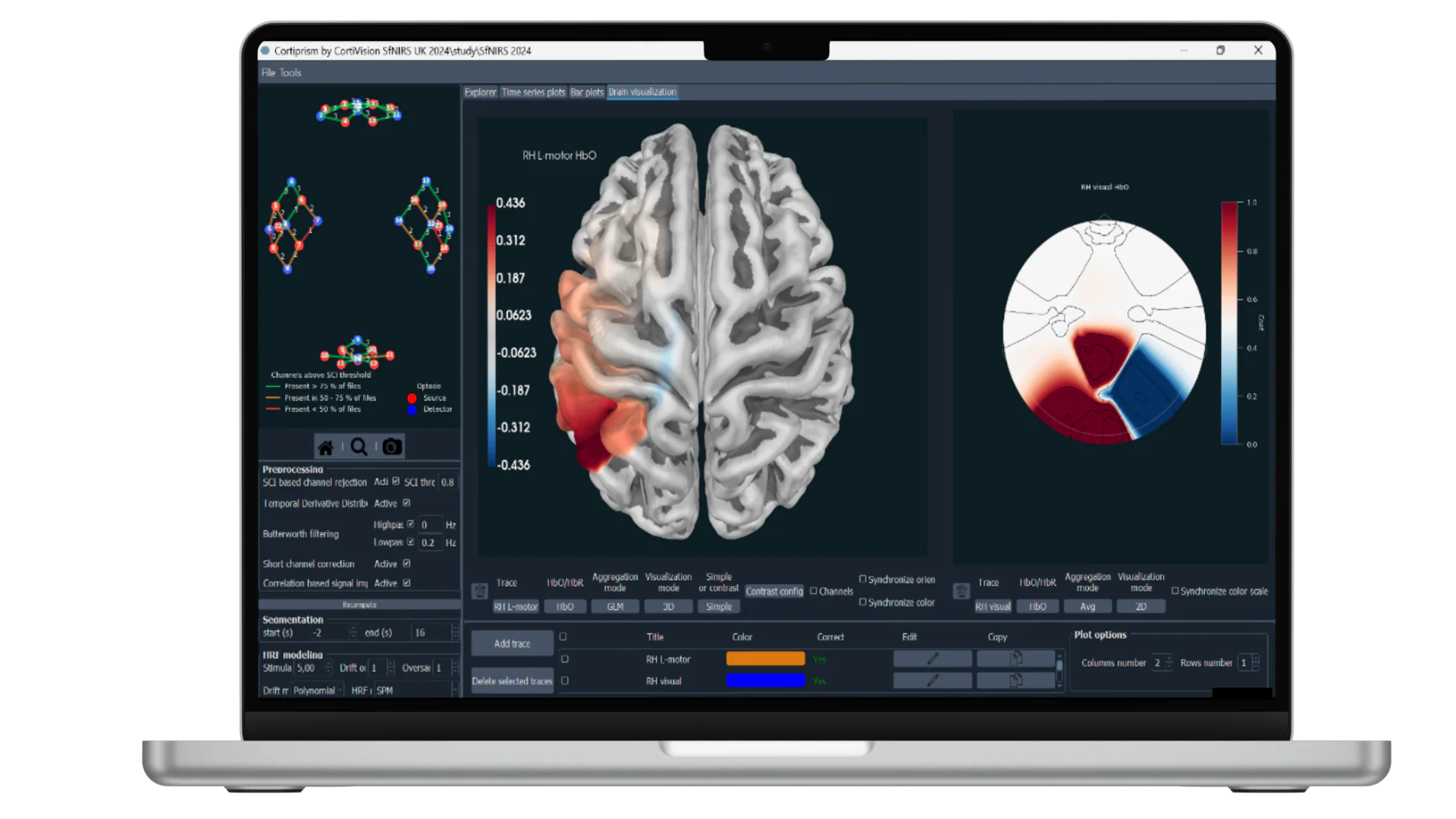 CortiPrism Software 1