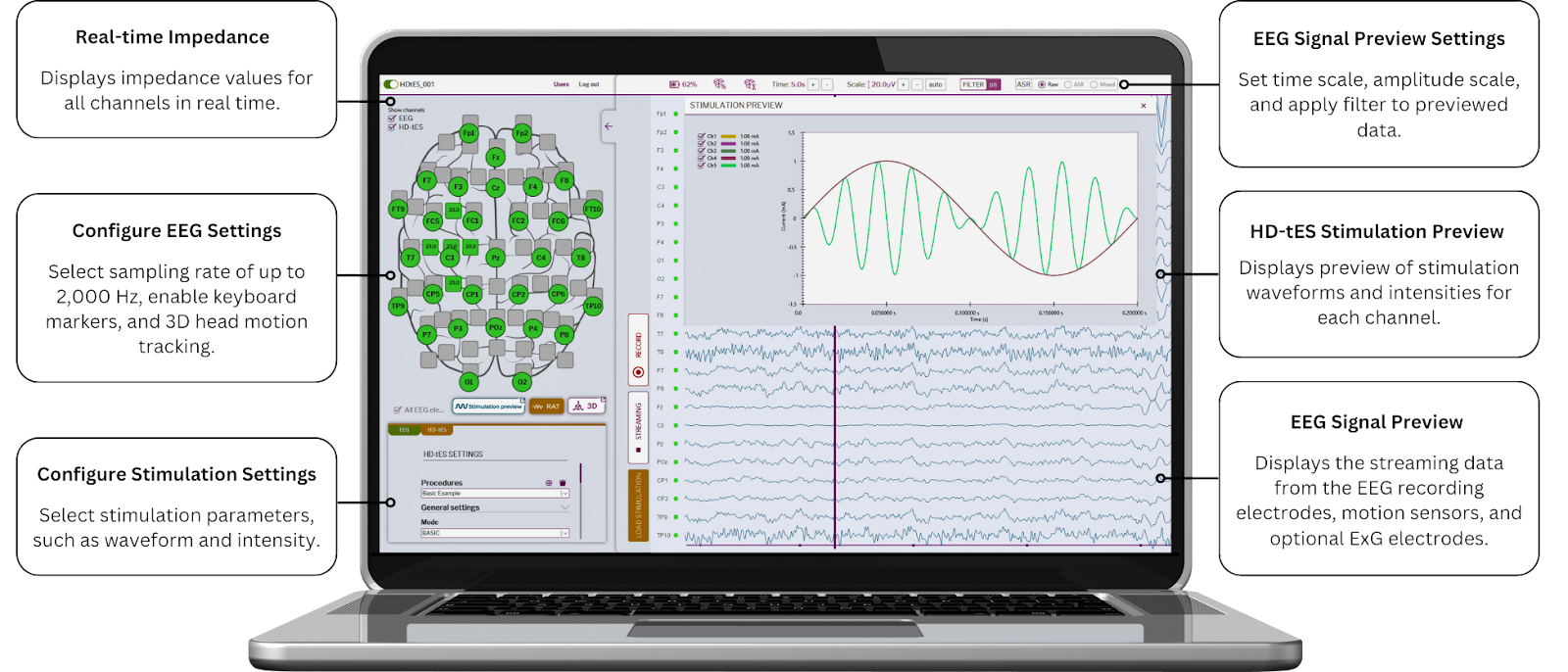 MxN-GO EEG Software | HD-tES & EEG Control | Aerobe | Aerobe
