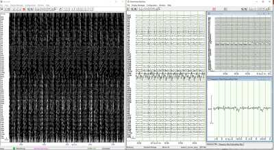 BrainVision RecView 2