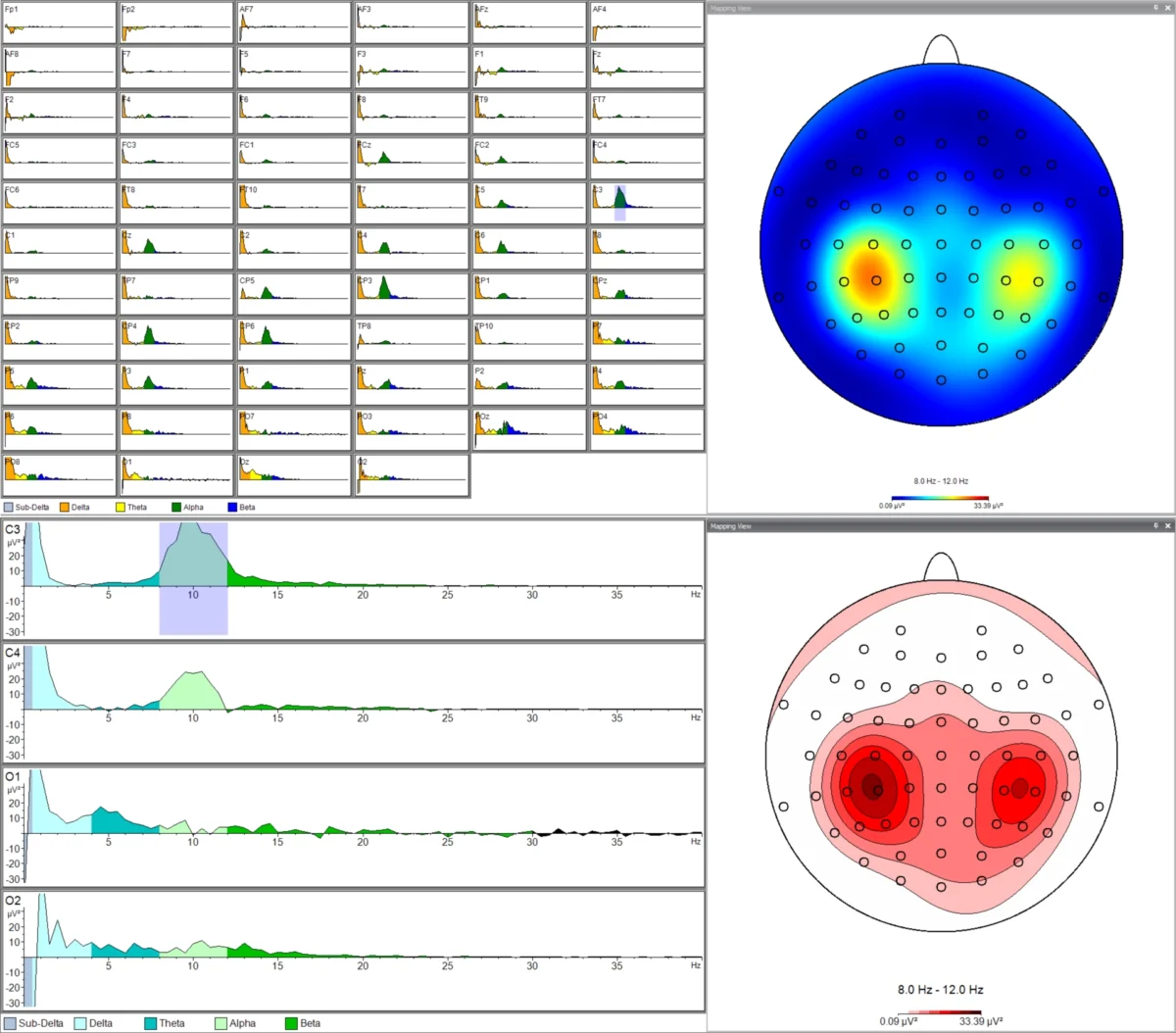 EEG Visualization & Plotting | BrainVision Analyzer Guide | Aerobe
