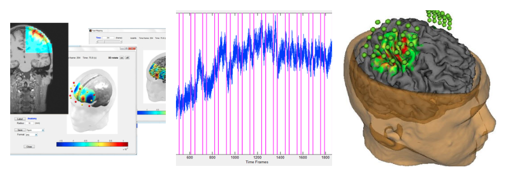 Satori - Post processing software for fNIRS