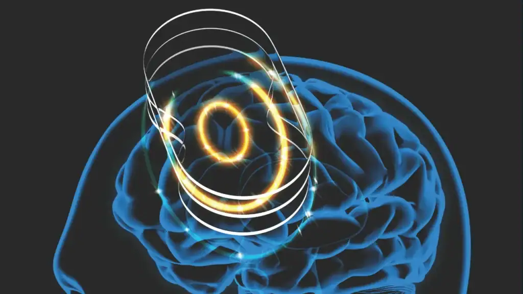 Clinical Neuronavigation for TMS | MagVenture Webinar 2026