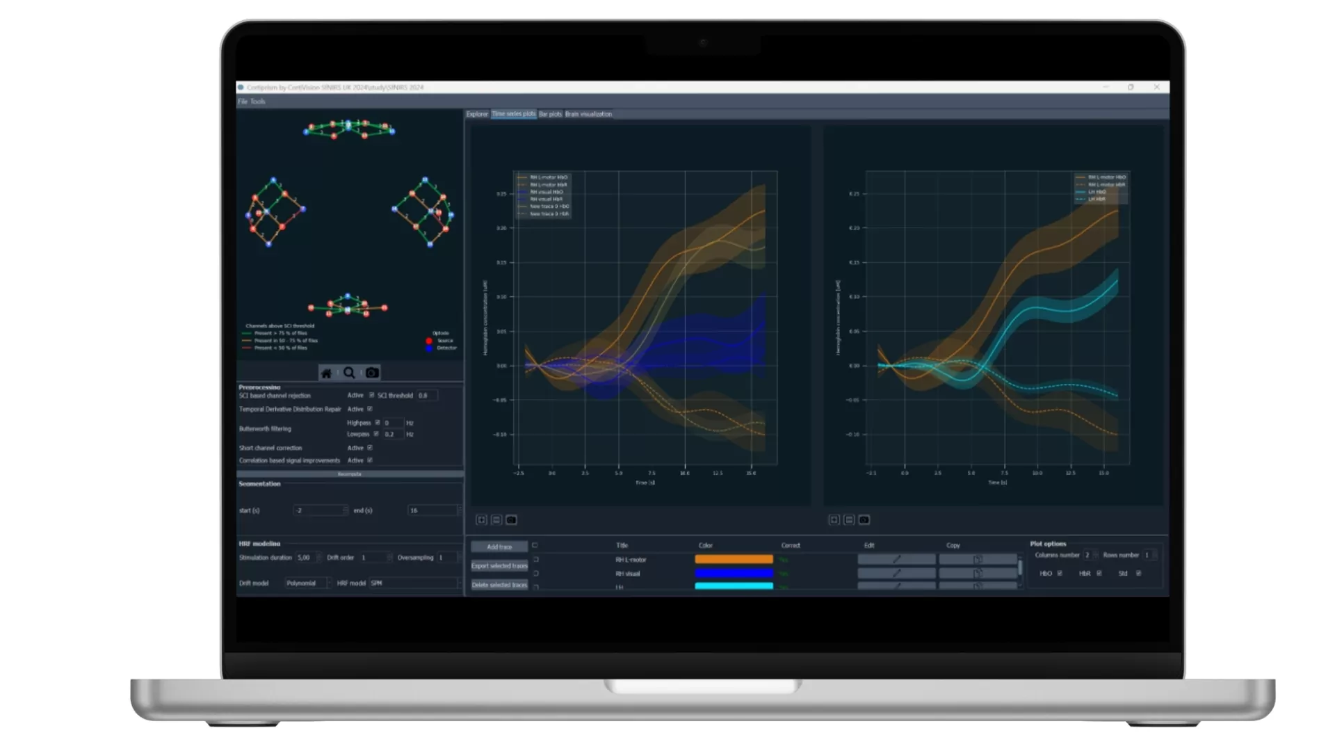 CortiPrism Software 2