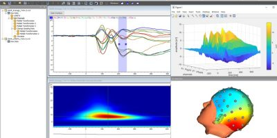 BrainVision Analyzer 2