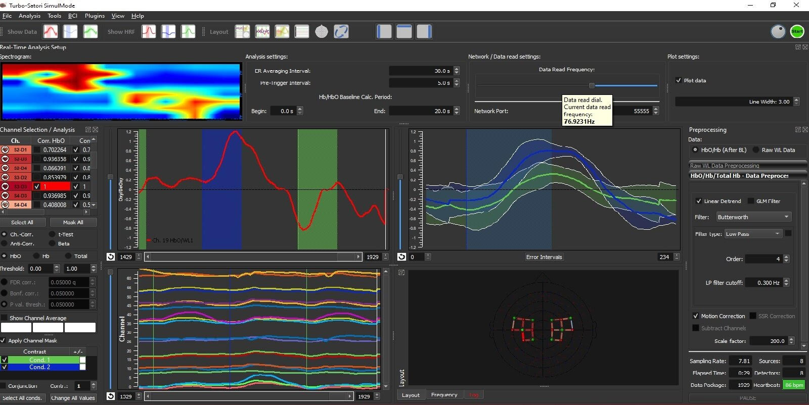 Turbo-Satori Software