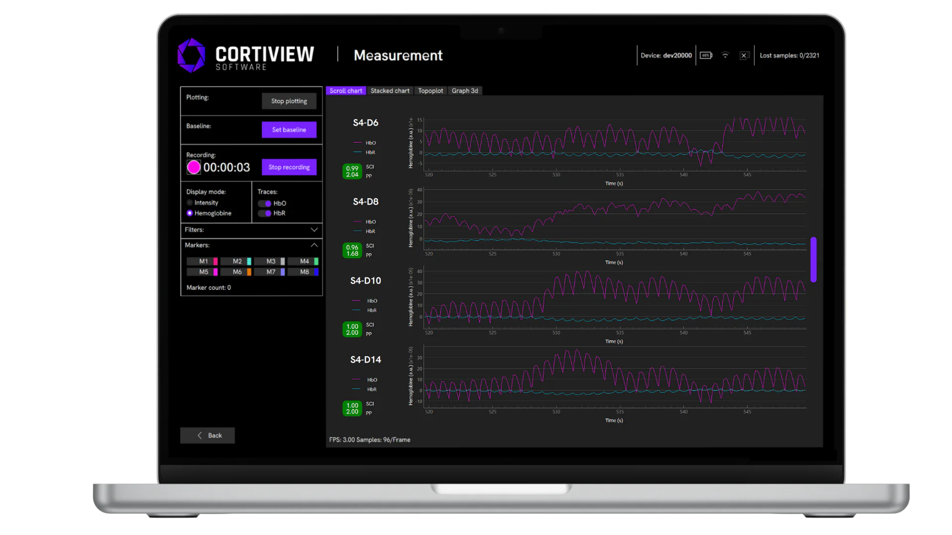 CortiView 2 Software 2